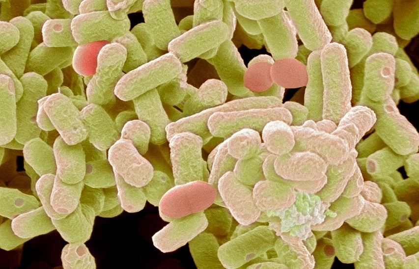 Escherichia coli, Staphylococcus aureus y Klebsiella pneumoniae, principales protagonistas de la resistencia a los antimicrobianos